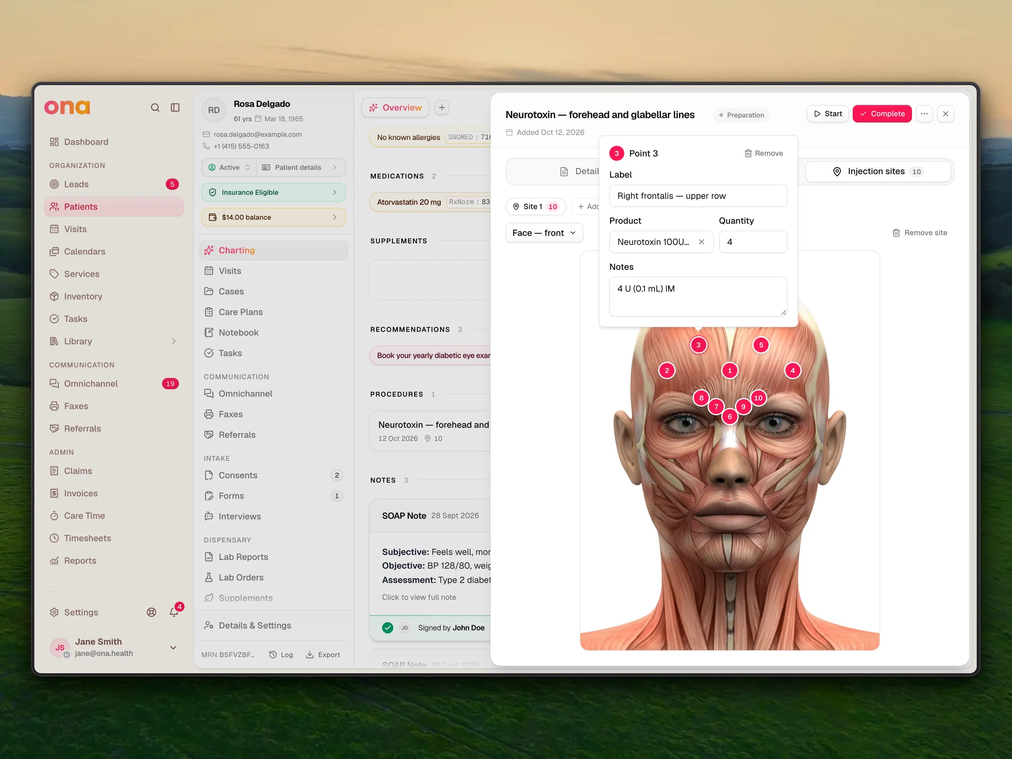 A procedure sheet open on the Injection sites tab: a Face — front diagram with numbered injection points across the forehead and glabellar lines, and one point's popover showing its label, notes, product and quantity