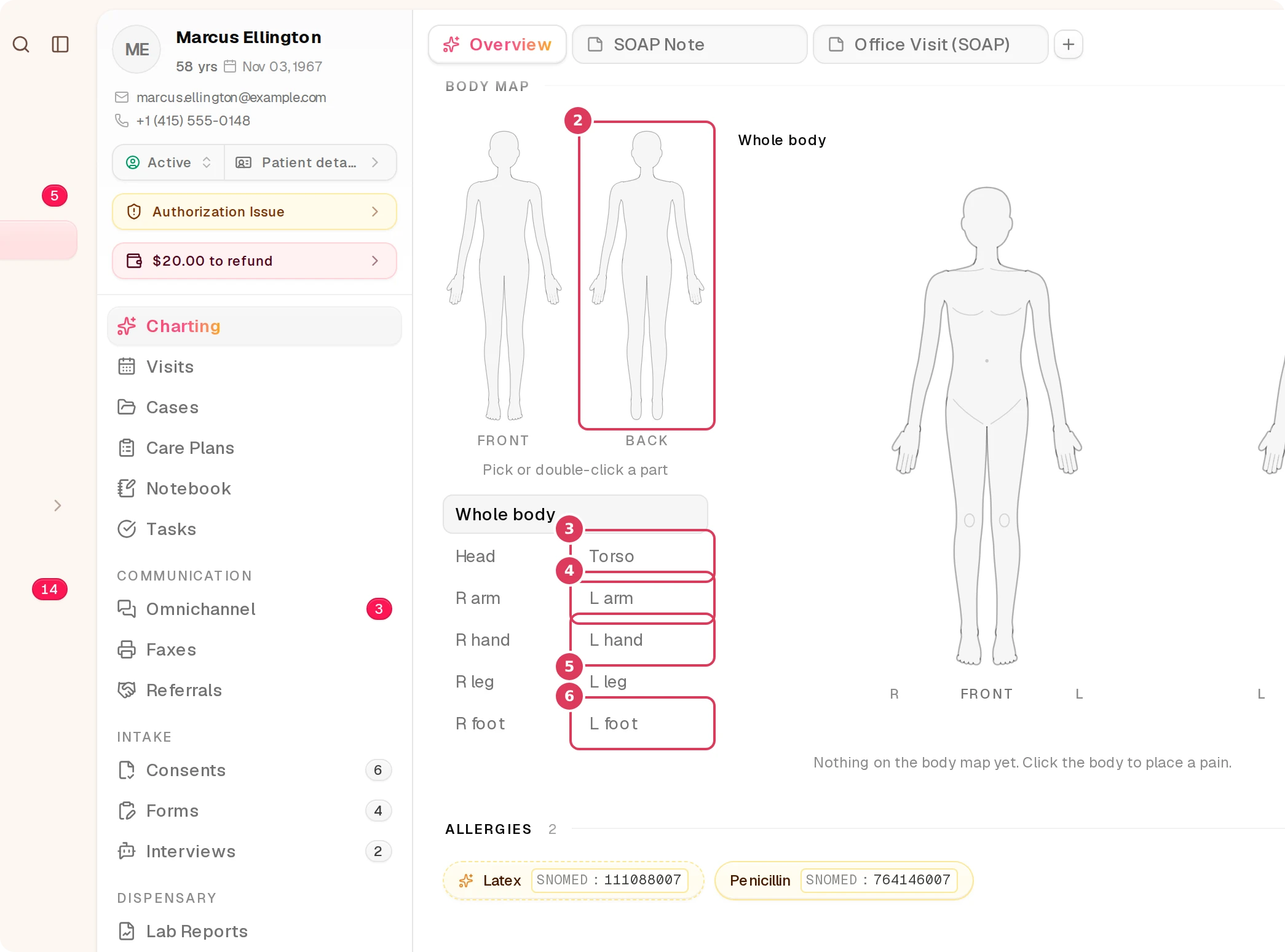 Marcus Ellington’s patient chart shows the Body map section with the back figure and focus chips that correspond to the back-view region labels.