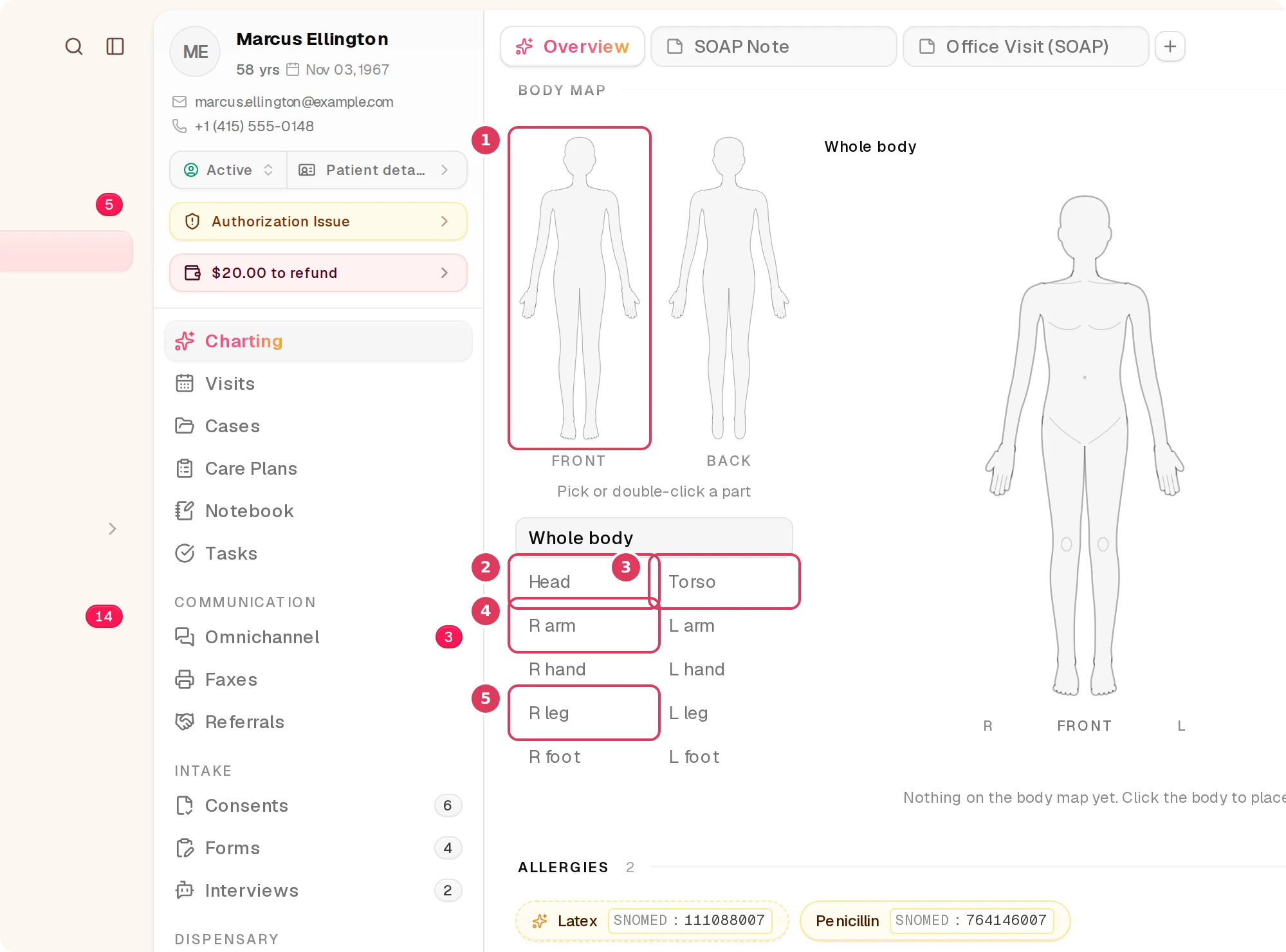Marcus Ellington’s patient chart shows the Body map section with the front figure and focus chips for front-view regions.